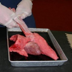 lung2