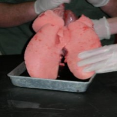 lung3