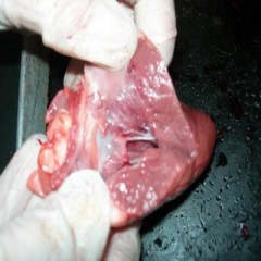 lung4
